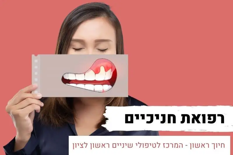 רפואת חניכיים