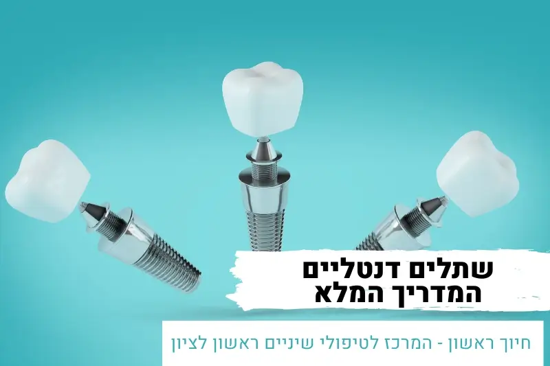 שתלים דנטליים המדריך המלא | מרפאת שיניים חיוך ראשון